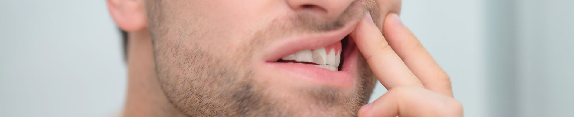 Cambio de color de diente por golpe