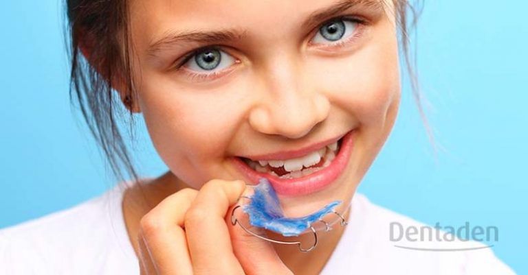 apiñamiento dental