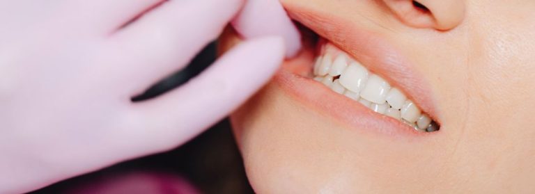 bolsas periodontales