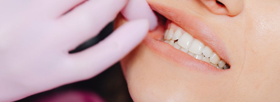 bolsas periodontales