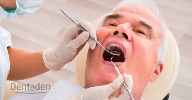 corona dental