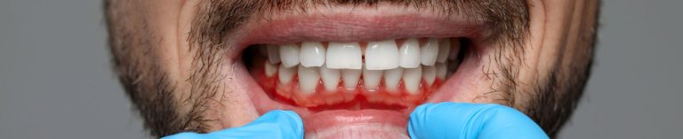 encias cambian de color