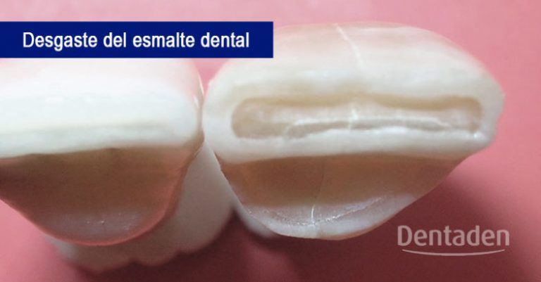esmalte dental