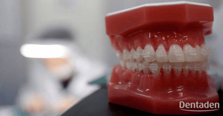higiene en prótesis dentales
