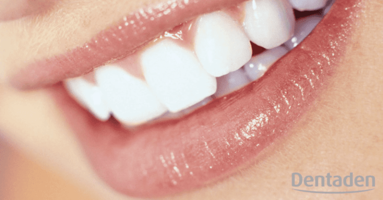sonrisa