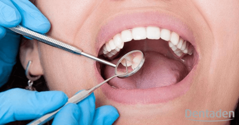 caries