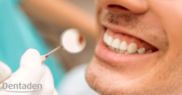 absceso dental