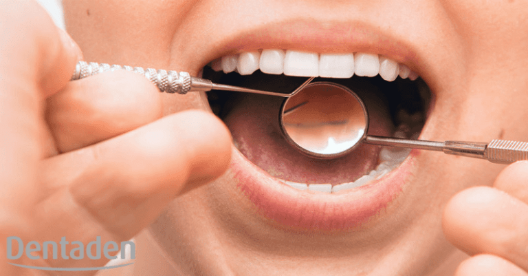 periodontitis
