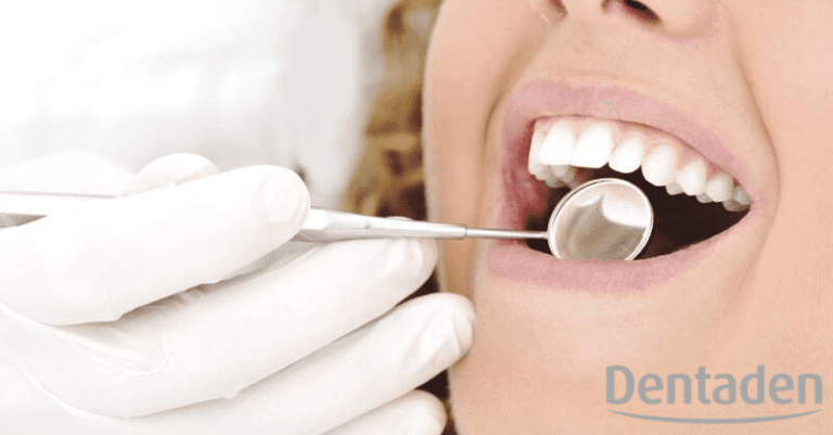 placa dental