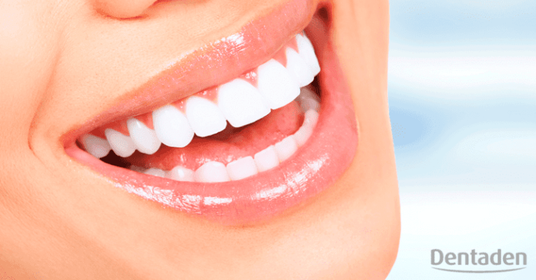 contorneado dental