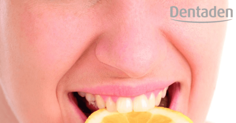 abrasión dental