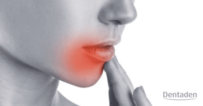 caries incipientes
