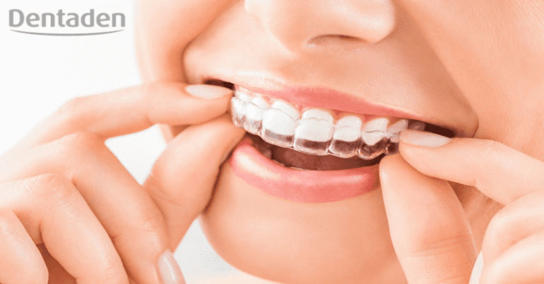ortodoncia invisalign