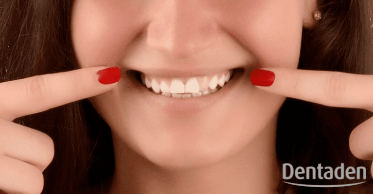 dientes grises