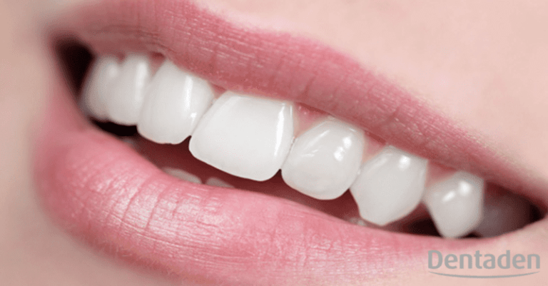 irrigación dental