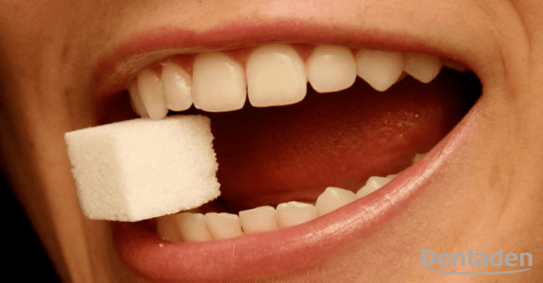 implantes dentales en diabéticos