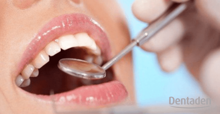 revisión del dentista
