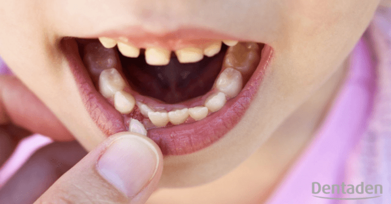 dientes de leche