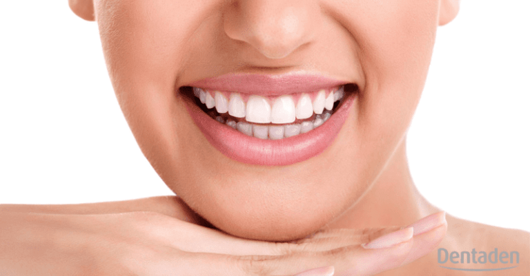 Blanqueamiendo dental
