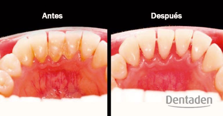 sarro dental